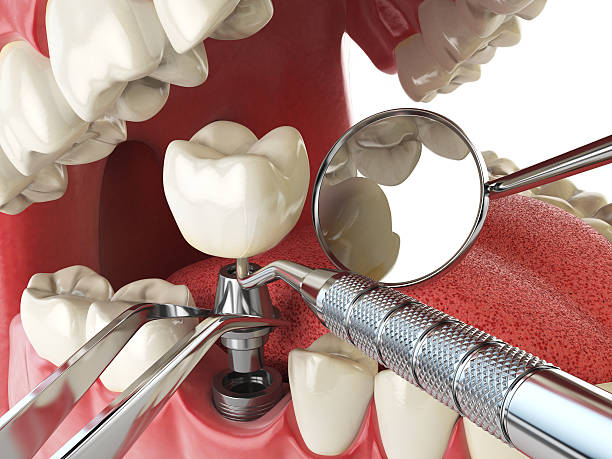 Best Emergency Gum Treatment in Fayette, OH